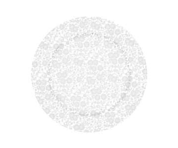 Vintage Lace Teller flach 30.5cm